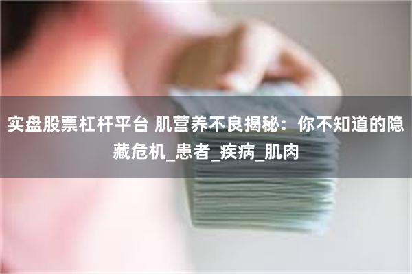 实盘股票杠杆平台 肌营养不良揭秘：你不知道的隐藏危机_患者_疾病_肌肉